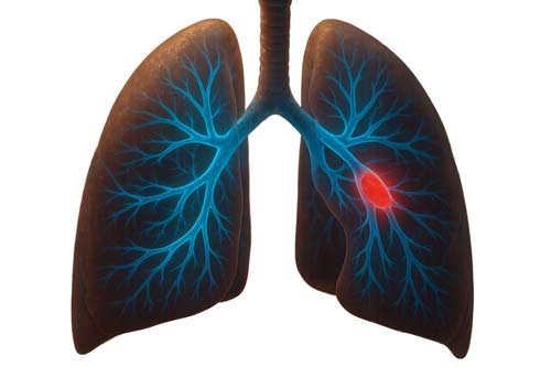 PE Protocol: Expert Guide to Managing Incidental Findings on CT Scans 1 Pe Protocol