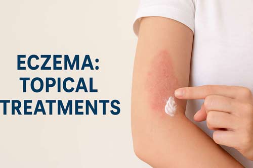 Eczema: Topical Treatments 1 Eczema