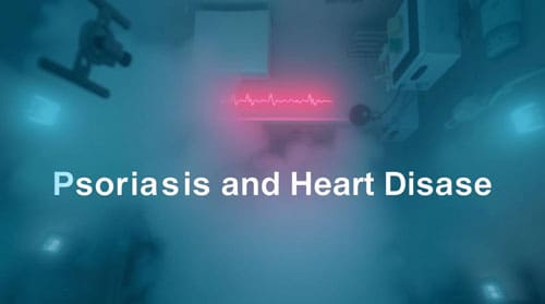 The Surprising Link Between Psoriasis and Heart Disease: What Patients Need to Know 1 Psoriasis And Heart Disease