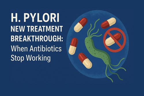 H Pylori New Treatment Breakthrough: When Antibiotics Stop Working 1 H. Pylori