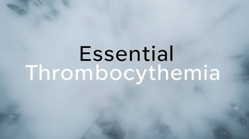 Aspirin Dosing Considerations In Essential Thrombocythemia: The ARES Trial 1 Essential Thrombocythemia